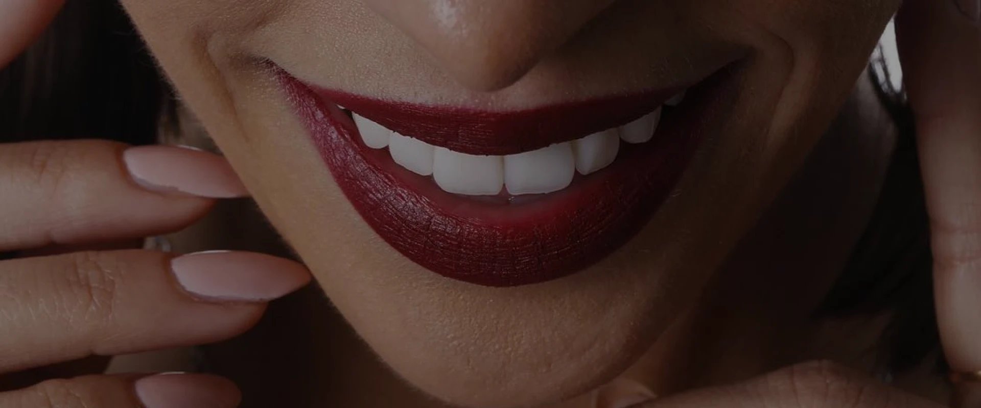 Traitement esthétique au Cabinet dentaire du Dr Mélanie Domingues, chirutgien-dentiste