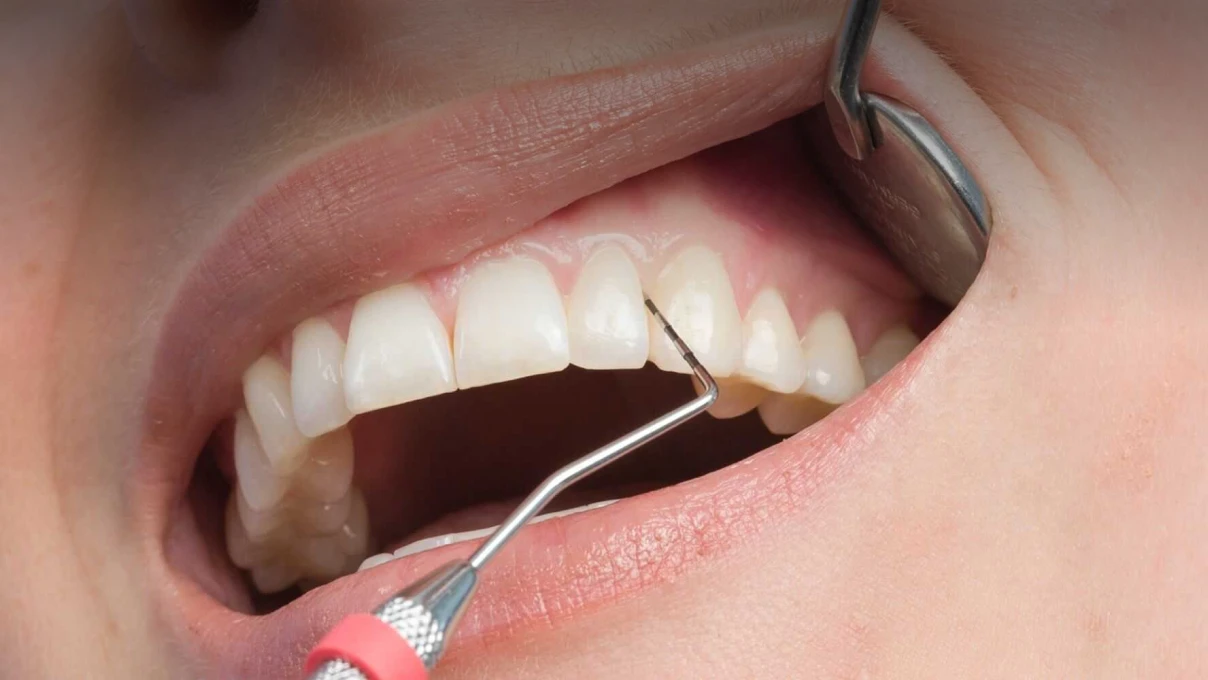 Chirurgie parodontale au Cabinet du Dr Domingues à Tigery 91250