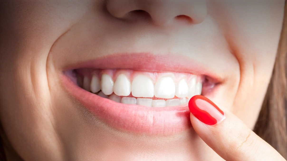 Composite injecté au Cabinet du Dr Mélanie Domingues à Tigery 91250